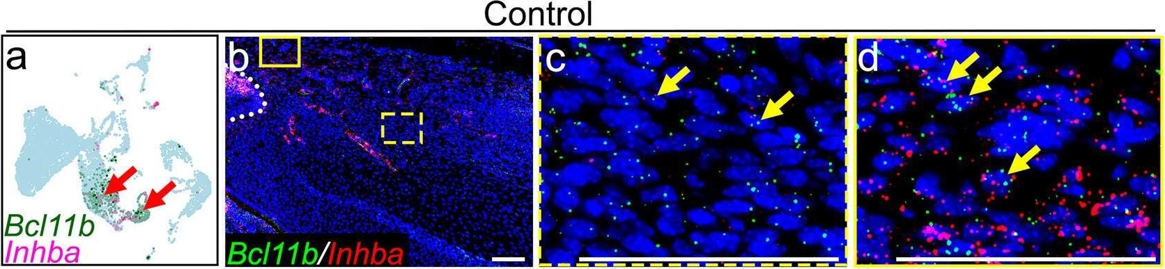 Fig.5.A showing Immunohistochemistry-immunofluorescence in a Mus musculus (House mouse) sample from the publication: ARID1B maintains mesenchymal stem cell quiescence via inhibition of BCL11B-mediated non-canonical Activin signaling.