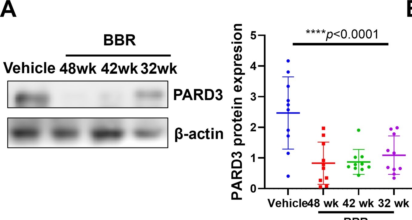 Fig.6.A showing Western Blotting from the publication: PARD3 drives tumorigenesis through activating Sonic Hedgehog signalling in tumour-initiating cells in liver cancer.