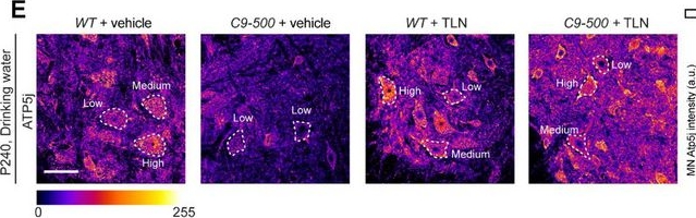 Fig.7.E showing Immunohistochemistry-immunofluorescence in a Mus musculus (House mouse) sample from the publication: Engineered GM1 Intersects Between Mitochondrial and Synaptic Pathways to Ameliorate ALS Pathology.