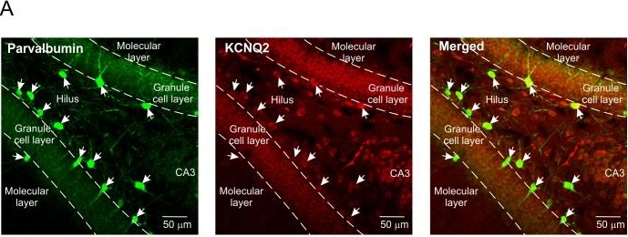 Fig.5.A showing Immunohistochemistry in a Rattus norvegicus (Rat) sample from the publication: BDNF Depresses Excitability of Parvalbumin-Positive Interneurons through an M-Like Current in Rat Dentate Gyrus.