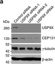 Fig.3.A showing Western Blotting in a Homo sapiens (Human) sample from the publication: USP9X regulates centrosome duplication and promotes breast carcinogenesis.