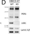 Fig.1.D showing Western Blotting in a Homo sapiens (Human) sample from the publication: High PER1 expression is associated with STK11 mutation and clinical biomarkers of immunotherapy resistance in lung adenocarcinoma.