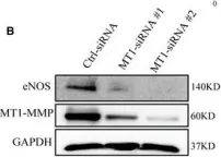 Fig.4.B showing Western Blotting in a Homo sapiens (Human) sample from the publication: Endothelial MT1-MMP targeting limits intussusceptive angiogenesis and colitis via TSP1/nitric oxide axis.