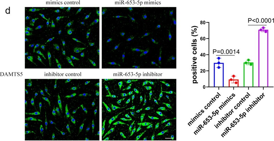 Fig.3.D showing Immunocytochemistry-immunofluorescence in a Homo sapiens (Human) sample from the publication: MiR-653-5p drives osteoarthritis pathogenesis by modulating chondrocyte senescence.
