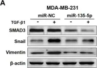 Fig.3.A showing Western Blotting in a Homo sapiens (Human) sample from the publication: MiR-135-5p inhibits TGF-β-induced epithelial-mesenchymal transition and metastasis by targeting SMAD3 in breast cancer.