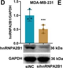 Fig.5.D showing Western Blotting in a Homo sapiens (Human) sample from the publication: Ferroptosis-dependent small extracellular vesicles ULK1 enhances mitophagy and suppresses breast cancer migration.