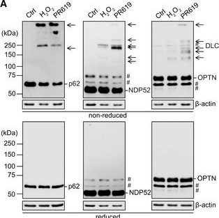 NDP52 acts as a redox sensor in PINK1/Parkin-mediated mitophagy.
