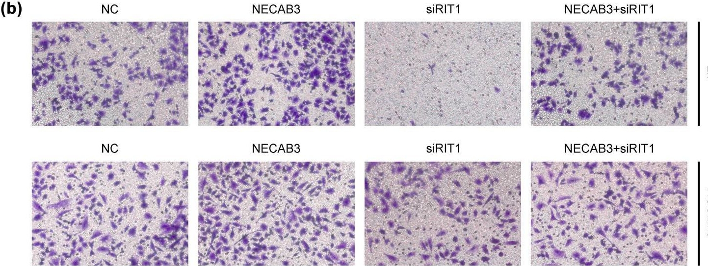 Fig.5.B showing Immunohistochemistry in a Homo sapiens (Human) sample from the publication: NECAB3 promotes the migration and invasion of liver cancer cells through HIF-1α/RIT1 signaling pathway.
