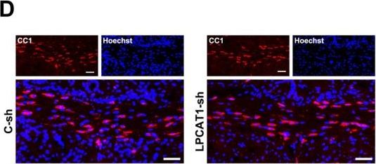 Fig.6.D showing Immunohistochemistry-immunofluorescence from the publication: LPCAT1, the Enzyme Responsible for Converting LPC to PC, Promotes OPC Differentiation In&nbsp;Vitro.