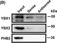 Fig.4.B showing Western Blotting in a Homo sapiens (Human) sample from the publication: PIN1P1 is activated by CREB1 and promotes gastric cancer progression via interacting with YBX1 and upregulating PIN1.
