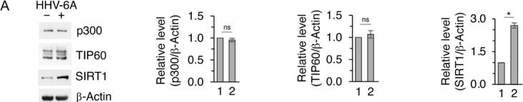 Fig.3.A showing Western Blotting in a Homo sapiens (Human) sample from the publication: HHV-6A Drives Epigenetic Reprogramming via an EZH2-SIRT1 Axis to Sustain Mutant p53 and Reshape Oncogenic Inflammatory Signaling.