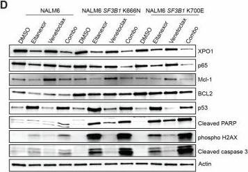 Fig.5.D showing Western Blotting from the publication: Altered RNA export by SF3B1 mutants confers sensitivity to nuclear export inhibition.