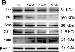 Fig.5.B showing Western Blotting in a Homo sapiens (Human) sample from the publication: Effects of metformin on Sonic hedgehog subgroup medulloblastoma progression: In vitro and in vivo studies.