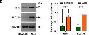 Fig.4.D showing Western Blotting in a Homo sapiens (Human) sample from the publication: miR-4652-3p suppresses glutamine metabolism induced by the inflammatory microenvironment in non-small cell lung cancer by regulating MYC/SLC1A5.