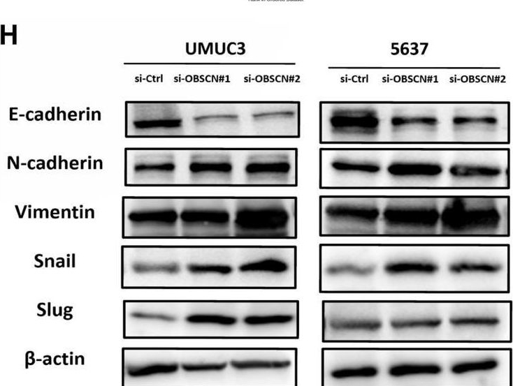 Fig.3.H showing Western Blotting from the publication: Loss of OBSCN expression promotes bladder cancer progression but enhances the efficacy of PD-L1 inhibitors.