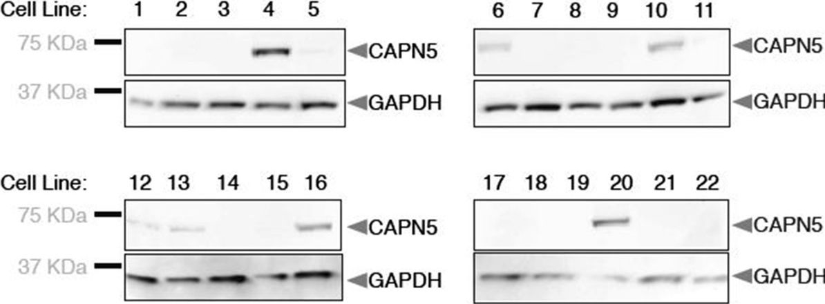 Fig.1.A showing Western Blotting in a Homo sapiens (Human) sample from the publication: CAPN5 gene silencing by short hairpin RNA interference.