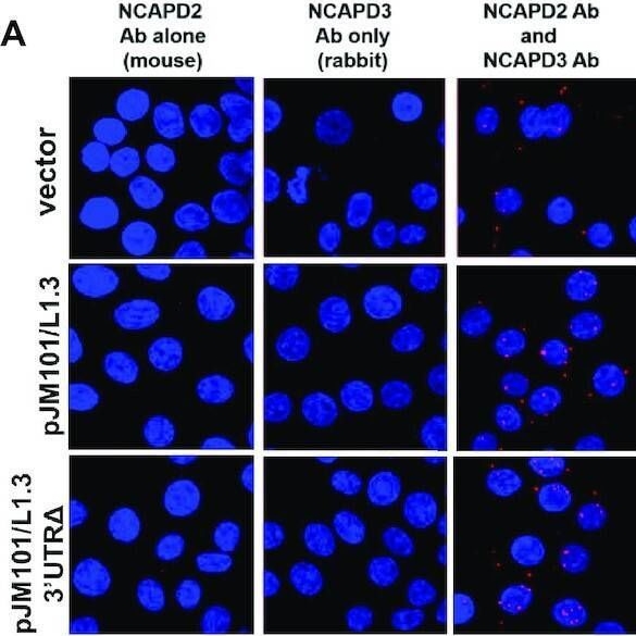 Fig.7.A showing Immunocytochemistry-immunofluorescence from the publication: Condensin I and condensin II proteins form a LINE-1 dependent super condensin complex and cooperate to repress LINE-1.