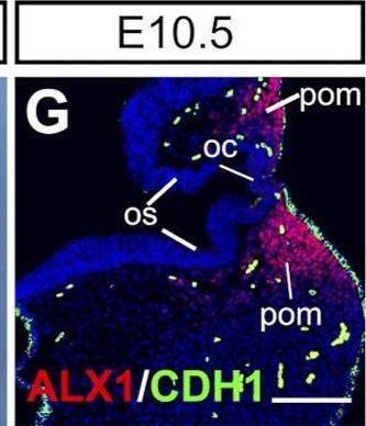 Fig.4.G showing Immunohistochemistry-immunofluorescence from the publication: Alx1 Deficient Mice Recapitulate Craniofacial Phenotype and Reveal Developmental Basis of ALX1-Related Frontonasal Dysplasia.
