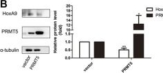 Fig.4.B showing Western Blotting in a Rattus norvegicus (Rat) sample from the publication: PRMT5 Prevents Cardiomyocyte Hypertrophy via Symmetric Dimethylating HoxA9 and Repressing HoxA9 Expression.