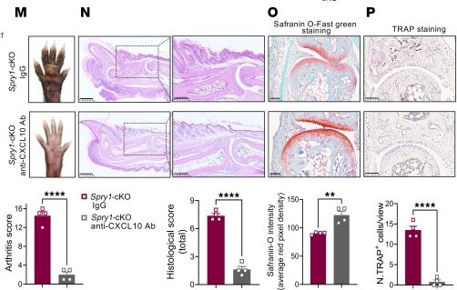 Fig.3.M showing Immunohistochemistry from the publication: CXCL10 secreted by SPRY1-deficient epidermal keratinocytes fuels joint inflammation in psoriatic arthritis via CD14 signaling.