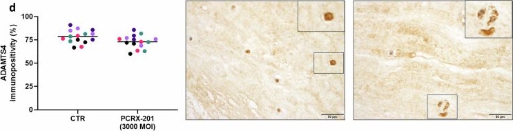 Fig.7.D showing Immunohistochemistry in a Homo sapiens (Human) sample from the publication: PCRX-201, a novel IL-1Ra gene therapy treatment approach for low back pain resulting from intervertebral disc degeneration.
