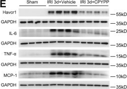 Fig.7.E showing Western Blotting from the publication: Temporal Proteomic and Phosphoproteomic Profiling Deciphers Molecular Dynamics of Acute-to-Chronic Kidney Disease After Ischemia-Reperfusion Injury, With Dock2 Emerging as a Key Regulator.