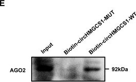 Fig.4.E showing Western Blotting from the publication: Circular RNA HMGCS1 sponges MIR4521 to aggravate type 2 diabetes-induced vascular endothelial dysfunction.