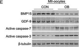 Fig.1.E showing Western Blotting from the publication: AMPK Suppression Due to Obesity Drives Oocyte mtDNA Heteroplasmy via ATF5-POLG Axis.