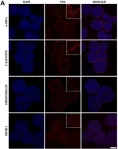 Fig.2.A showing Immunohistochemistry-immunofluorescence in a Homo sapiens (Human) sample from the publication: Improved contractile potential in detrusor microtissues from pediatric patients with end stage lower urinary tract dysfunction.
