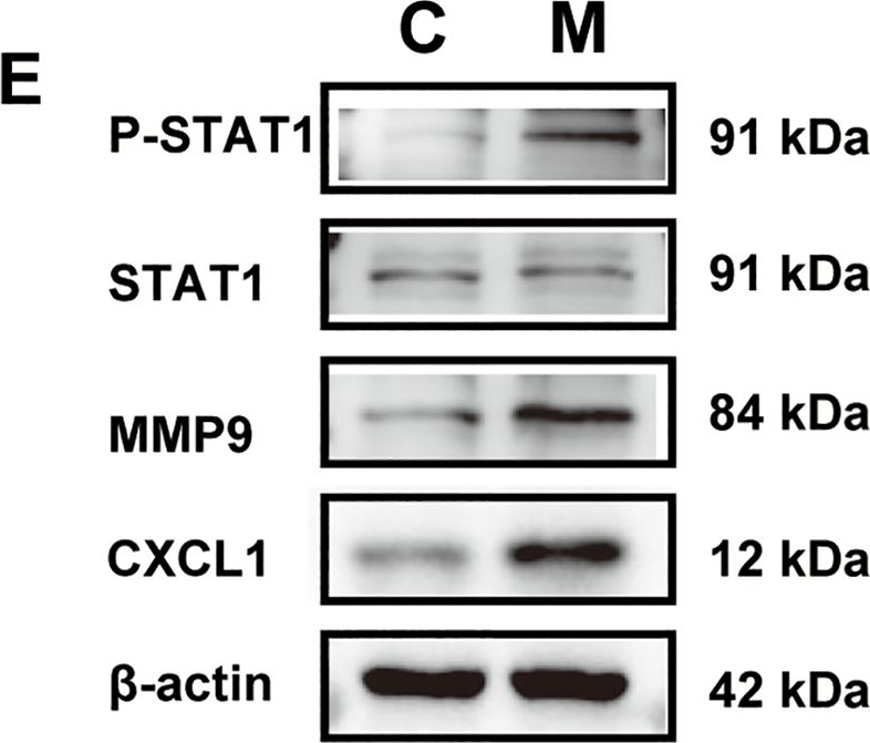 Fig.8.E showing Western Blotting from the publication: Multi-omics analysis reveals diagnostic and therapeutic biomarkers for aging phenotypes in ulcerative colitis.