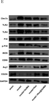 Fig.6.E showing Western Blotting in a Mus musculus (House mouse) sample from the publication: Clec7a-targeted Res@GelMA hydrogels regulate macrophage polarization to reduce neuroinflammation and promote spinal cord repair.