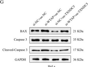 Fig.6.G showing Western Blotting in a Homo sapiens (Human) sample from the publication: WTAP-Mediated m6A Modification of TXNDC5 mRNA Promotes Cervical Carcinogenesis.