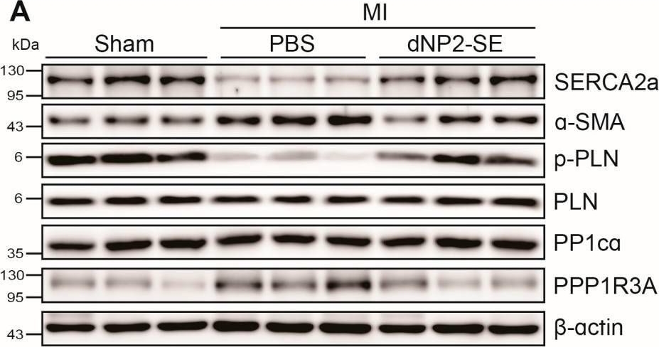 Fig.4.A showing Western Blotting in a Mus musculus (House mouse) sample from the publication: Intratracheal Delivery of a Phospholamban Decoy Peptide Attenuates Cardiac Damage Following Myocardial Infarction.