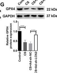 Fig.7.G showing Western Blotting from the publication: METTL3 mediates m6A methylation of LCN2 through IGF2BP3 to promote ferroptosis in chronic obstructive pulmonary disease.
