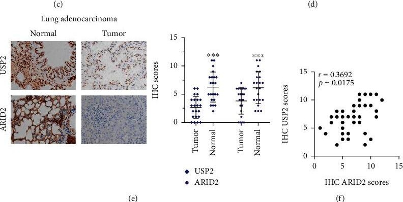 Fig.6.C showing Immunohistochemistry from the publication: USP2 Inhibits Lung Cancer Pathogenesis by Reducing ARID2 Protein Degradation via Ubiquitination.
