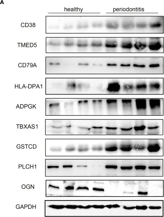 Fig.7.A showing Western Blotting from the publication: Identification of nine signature proteins involved in periodontitis by integrated analysis of TMT proteomics and transcriptomics.