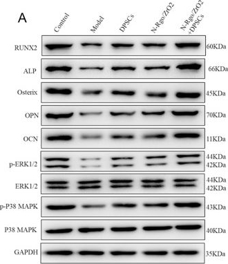 Fig.5.A showing Western Blotting in a Rattus norvegicus (Rat) sample from the publication: Zirconia/dental pulp stem cell composite scaffolds repair osteogenic defect via regulating macrophages.