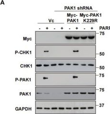 Fig.3.A showing Western Blotting in a Homo sapiens (Human) sample from the publication: PAK1 inhibition synergistically enhances the anti-tumor efficacy of PARP inhibitors in ovarian cancers.