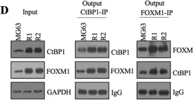 Fig.4.D showing Western Blotting from the publication: Targeting the CtBP1-FOXM1 transcriptional complex with small molecules to overcome MDR1-mediated chemoresistance in osteosarcoma cancer stem cells.