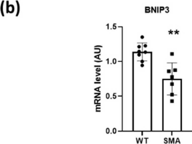 Fig.6.B from the publication: Diaphragm Fatigue in SMNΔ7 Mice and Its Molecular Determinants: An Underestimated Issue.