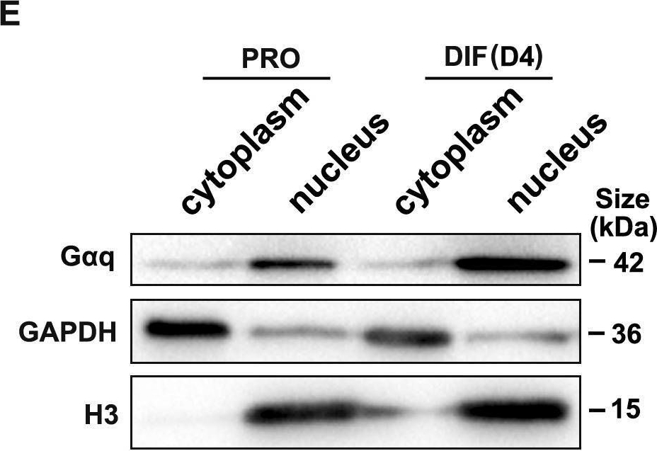 Fig.1.E showing Western Blotting in a Homo sapiens (Human) sample from the publication: Gαq-PKD/PKCμ signal regulating the nuclear export of HDAC5 to induce the IκB expression and limit the NF-κB-mediated inflammatory response essential for early pregnancy.