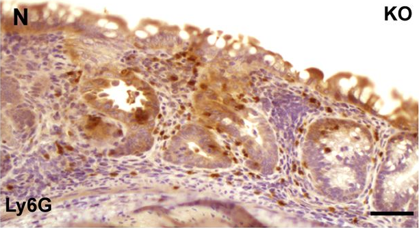 Fig.5.N showing Immunohistochemistry in a Mus musculus (House mouse) sample from the publication: hnRNP I regulates neonatal immune adaptation and prevents colitis and colorectal cancer.