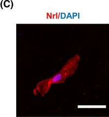 Fig.6.C showing Immunocytochemistry-immunofluorescence in a Homo sapiens (Human) sample from the publication: SOX2-positive retinal stem cells are identified in adult human pars plicata by single-cell transcriptomic analyses.