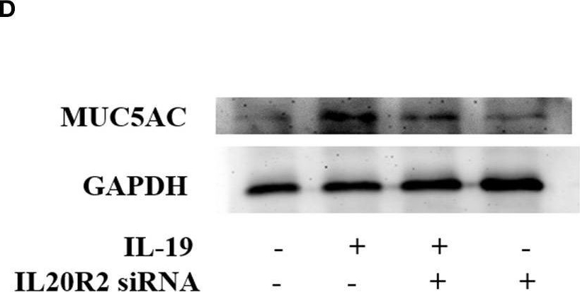 Fig.3.D showing Western Blotting in a Homo sapiens (Human) sample from the publication: IL-19 Up-Regulates Mucin 5AC Production in Patients With Chronic Rhinosinusitis via STAT3 Pathway.