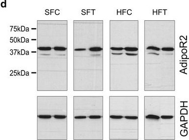 Fig.6.D showing Western Blotting in a Mus musculus (House mouse) sample from the publication: Interactions of exercise training and high-fat diet on adiponectin forms and muscle receptors in mice.