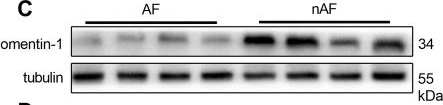 Fig.1.C showing Western Blotting in a Homo sapiens (Human) sample from the publication: Omentin-1 is associated with atrial fibrillation in patients with cardiac valve disease.