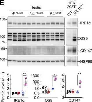 Fig.3.E showing Western Blotting in a Homo sapiens (Human) sample from the publication: The ER-associated degradation adaptor SEL1L is dispensable for ER homeostasis and the differentiation of spermatogenic cells.