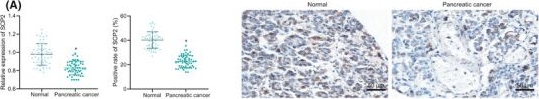 Fig.4.A showing Immunohistochemistry from the publication: LINC00261 elevation inhibits angiogenesis and cell cycle progression of pancreatic cancer cells by upregulating SCP2 via targeting FOXP3.