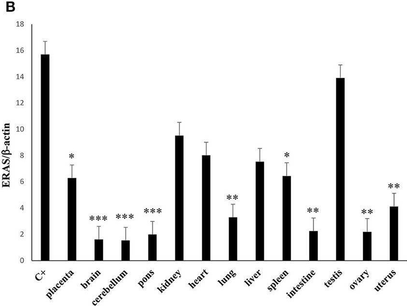 Fig.3.B from the publication: ERAS Is Constitutively Expressed in the Tissues of Adult Horses and May Be a Key Player in Basal Autophagy.