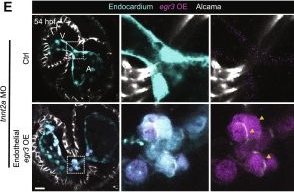 Fig.5.E showing Immunocytochemistry-immunofluorescence in a Danio rerio (Zebrafish) sample from the publication: egr3 is a mechanosensitive transcription factor gene required for cardiac valve morphogenesis.